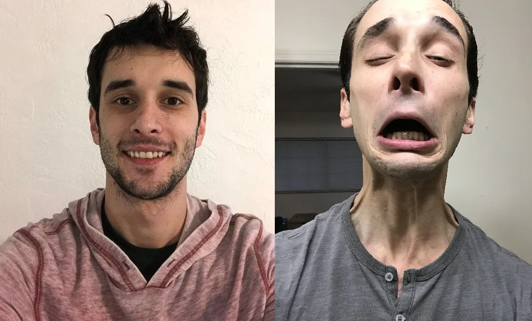 Kyle's before and entry comparison